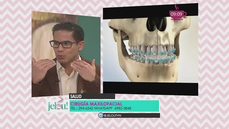 ¿Qué es la Cirugía maxilofacial?