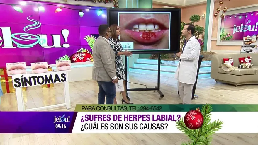 ¿Sufres de herpes labial? ¿Cuáles son sus causas?