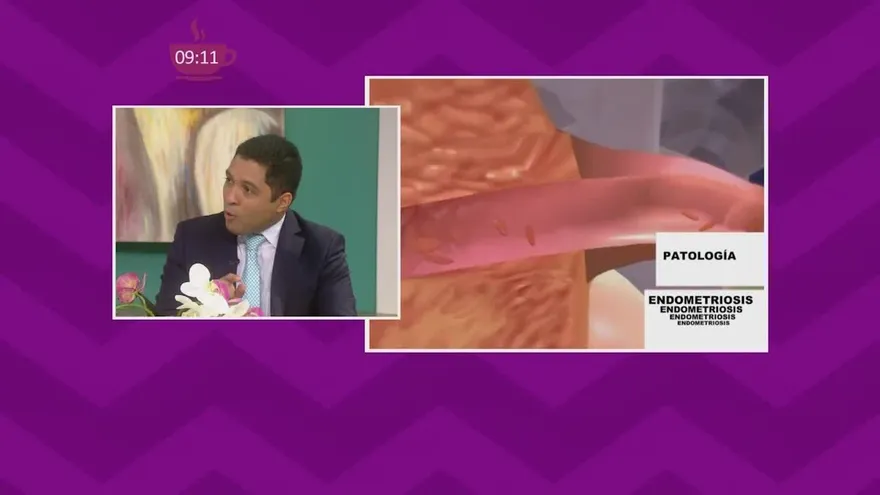 ¿Cólicos demasiado fuertes? ¡Cuidado! Podría ser endometriosis