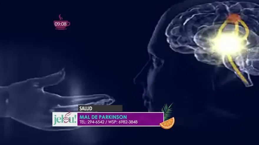 Cómo identificar si el temblor de las manos es inicio de mal de Parkinson