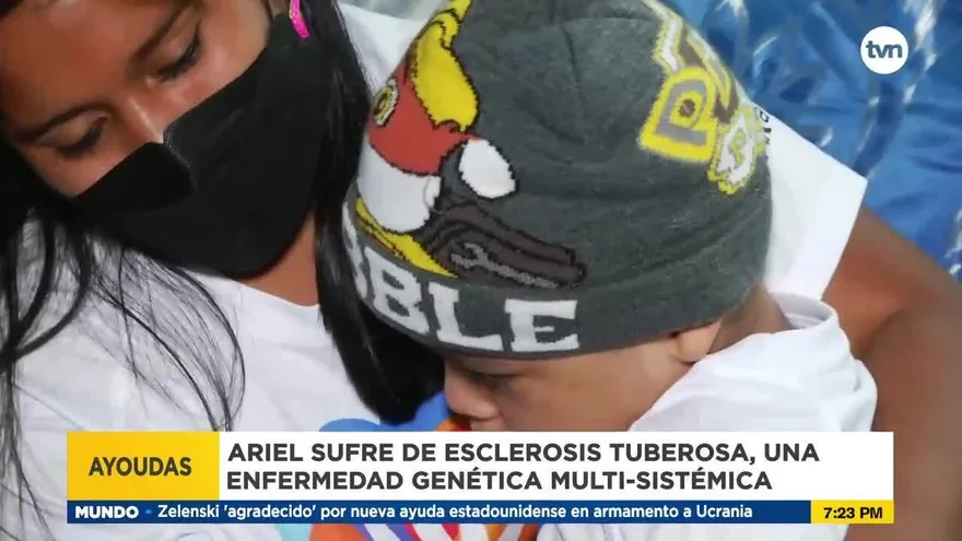 Ariel, un niño que sufre de esclerosis tuberosa necesita tu ayuda