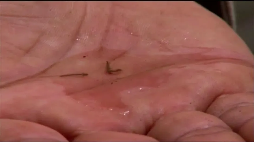 Incrementan índices de infestación del dengue