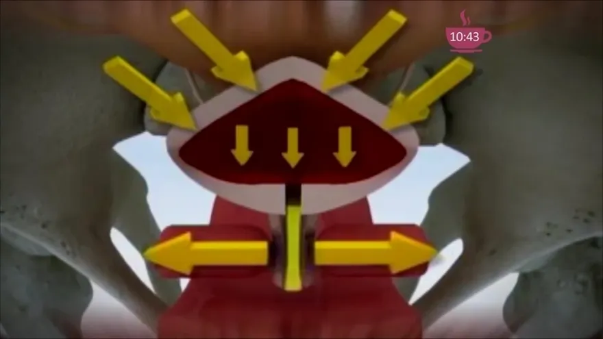 Incontinencia urinaria.