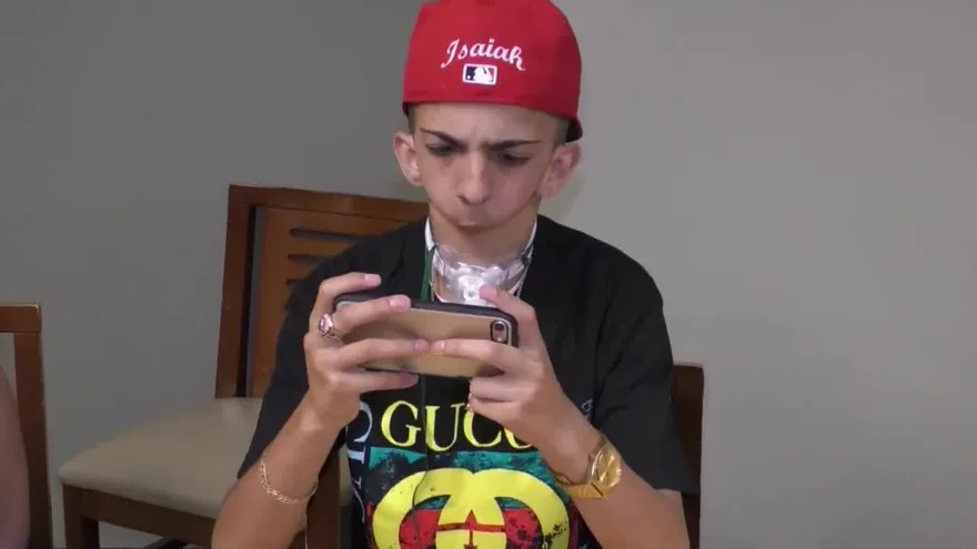 Isaiah Acosta, un joven sin mandíbula y sin voz que inspira al mundo