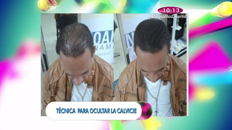 Buen Look - Pedro nos enseña, técnica para ocultar la calvicie