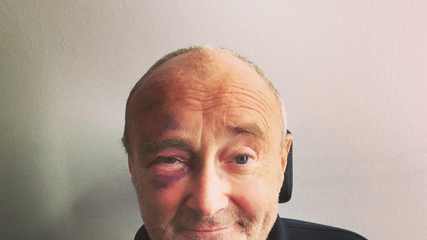 Cantante Phil Collins sufre accidente y queda hospitalizado. Fotografía @PhilCollinsFeed