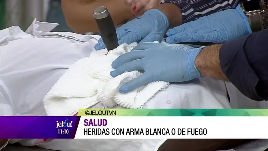 Primeros auxilios ante heridas con arma blanca o de fuego