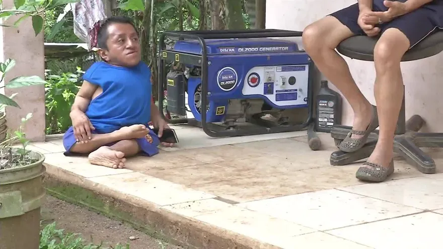 La historia del “hombre de cristal” que lucha por salir adelante