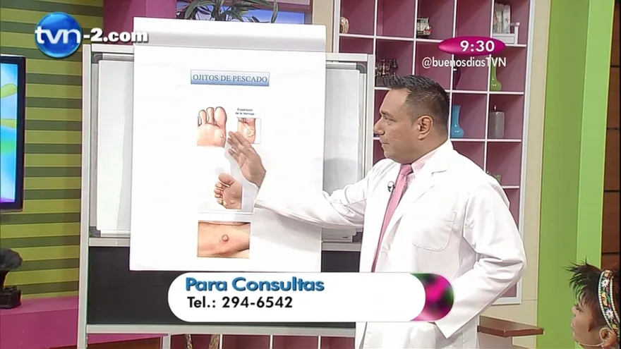 Segmento de Salud al día "Ojo de Pescado"