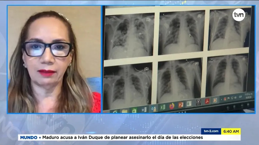 Técnicos en radiología médica amenazan con irse a paro