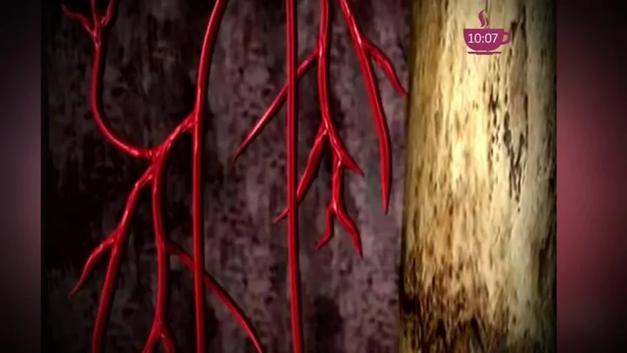 La anemia, sus síntomas y sus complicaciones