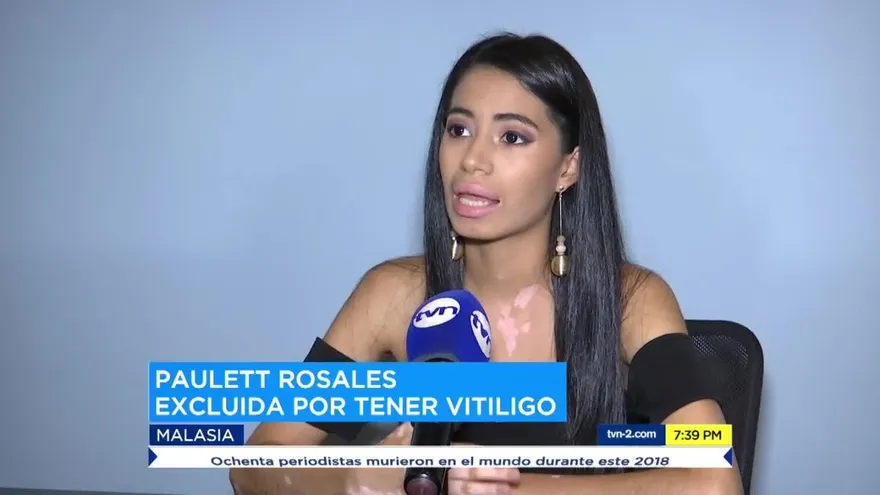 Analizan demandar a Miss Turismo Internacional por discriminación