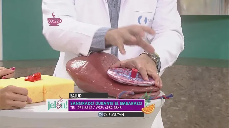 Qué significa tener sangrados vaginales durante el embarazo