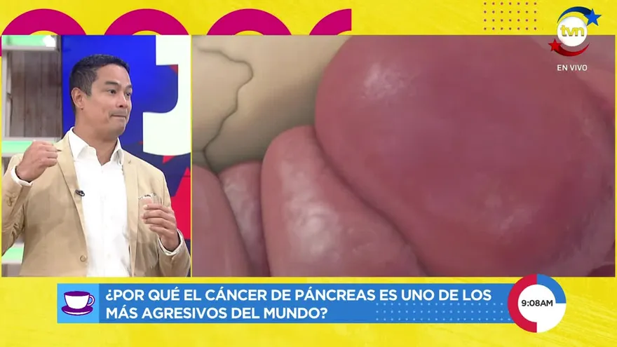 ¿Por qué el cáncer de páncreas es uno de los más agresivos del mundo?