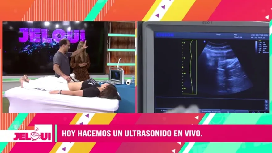 Cita Médica: Ultrasonido pélvico en vivo