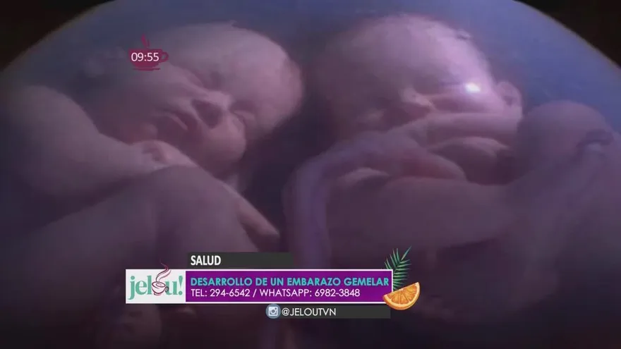 ¿Qué tan riesgoso es ahora un embarazo de gemelos?