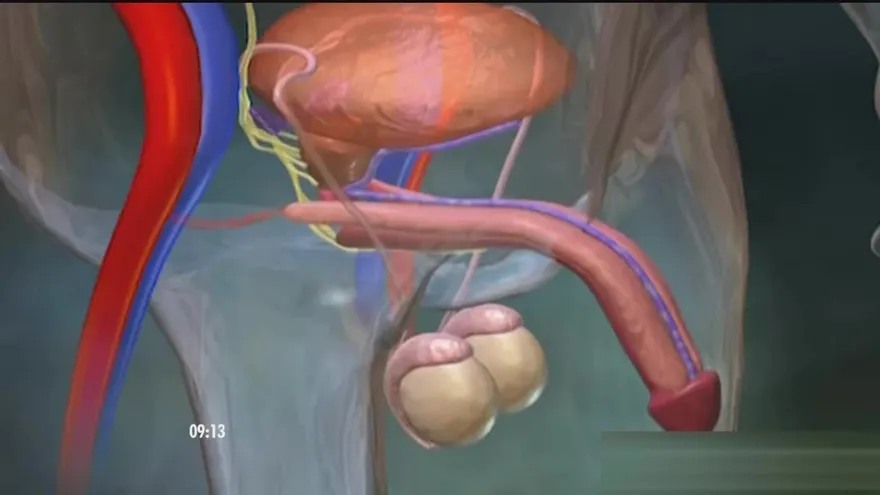 ¡Detecta si sufres disfunción eréctil!
