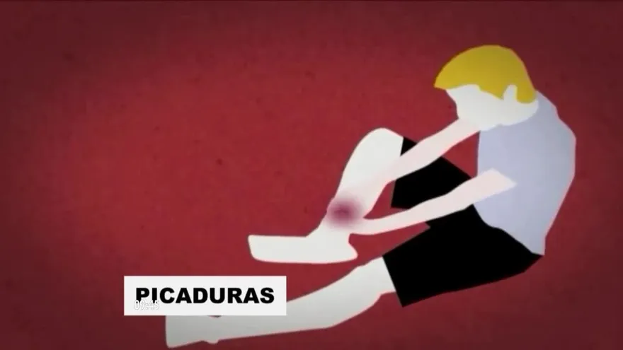 Consecuencias de picadura y mordedura de animales