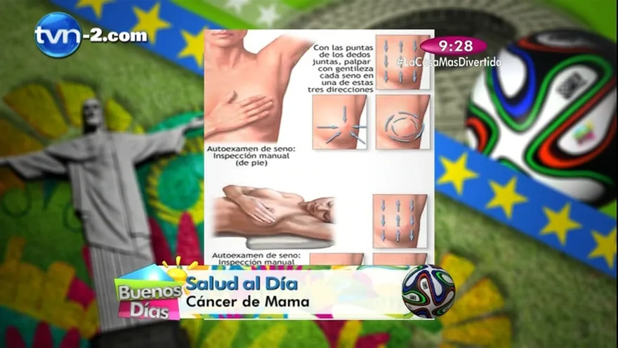 Segmento Salud al Día - Cáncer de Mama