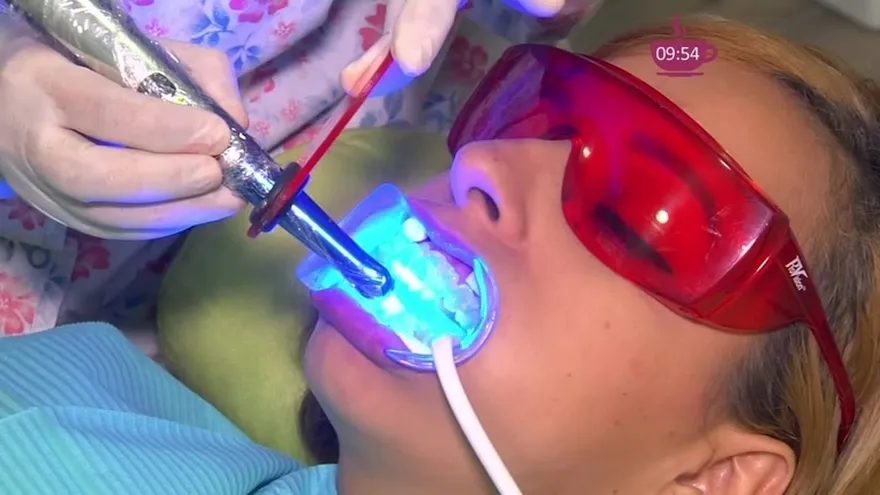 ¡Blanqueamiento dental! Todo lo que necesitas saber sobre este tratamiento