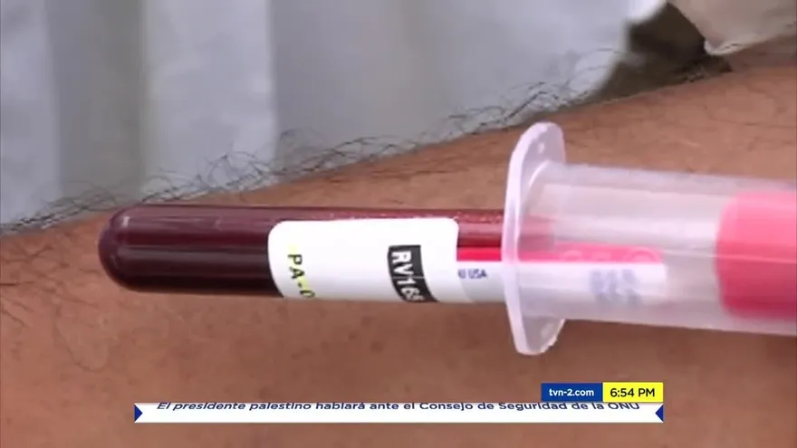 Preocupación por aumento de casos de SIDA en Panamá