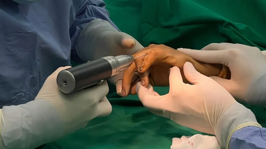 CSS realiza primera osteotomía rotacional de alta complejidad en Veraguas