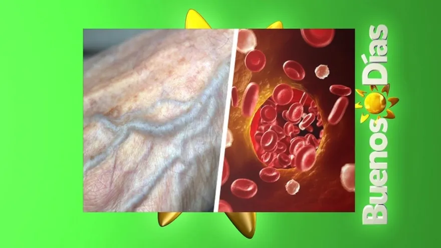 Sientes adormecimiento de diferentes partes del cuerpo, hormigueo tal vez estés sufriendo de mala circulación