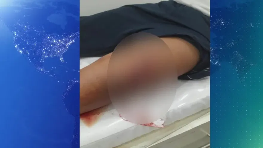 Estudiante herido en escuela cuando se encontraba dando clases