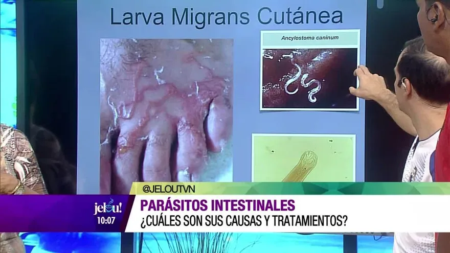 Parásitos intestinales ¿Cuáles son sus causas y tratamientos?