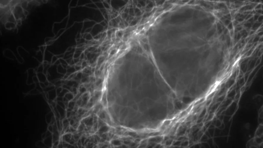 Hallazgo explica los efectos nocivos de algunos tratamientos contra el cáncer