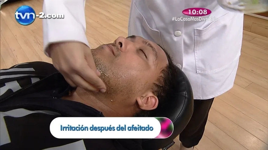 Estética - Irritación después del afeitado