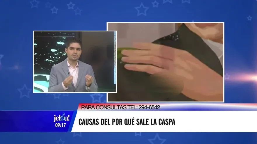 Conoce las causas del por qué nos sale caspa