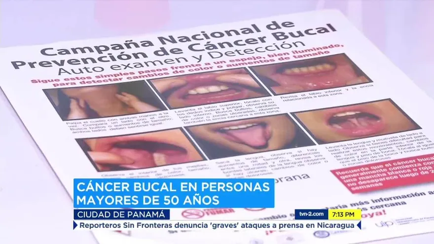 3 de cada 10 mil habitantes tiene cáncer bucal en Panamá