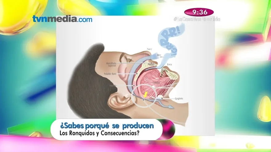 Salud al día - Sabes porqué  se  producen Los Ronquidos al Dormir y cuales son las  consecuencias para nuestra salud ?