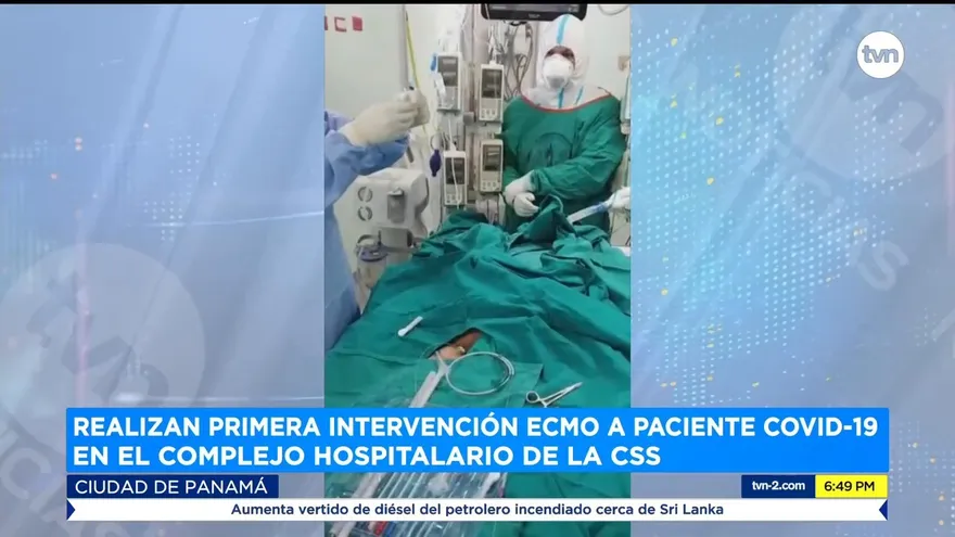 Por primera vez la CSS realiza terapia ECMO en paciente con covid-19