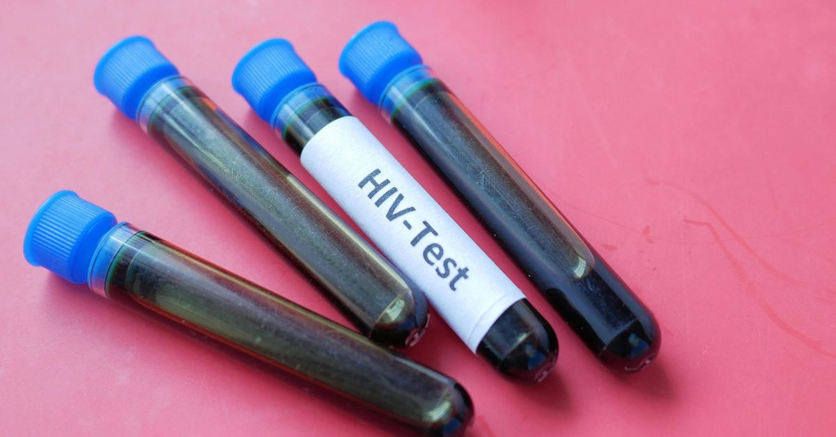 Laboratorio sudafricano producirá nuevo tratamiento contra el VIH para África
