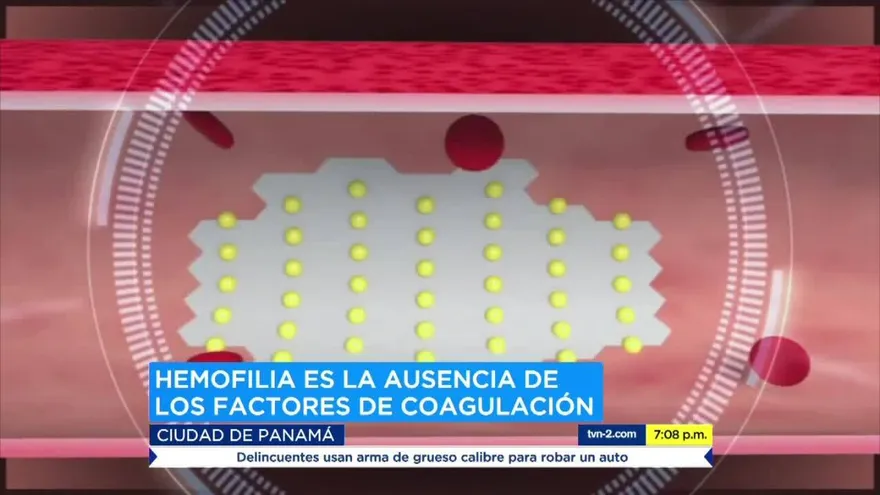 Realizan Cumbre de las Américas en Hemofilia