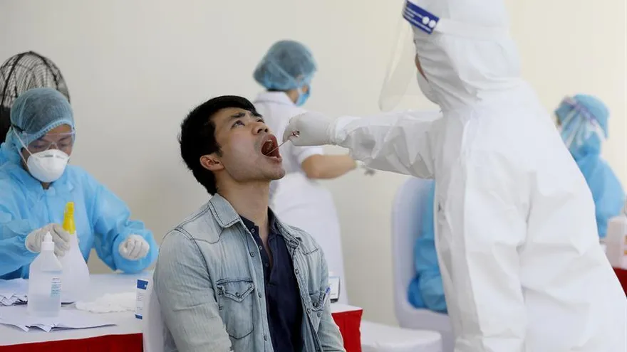 Los casos de COVID-19 en el planeta confirmados por la Organización Mundial de la Salud (OMS) alcanzaron hoy la cifra de los 20,9 millones, mientras que los fallecidos son 760.774, según las estadísticas del organismo con sede en Ginebra.