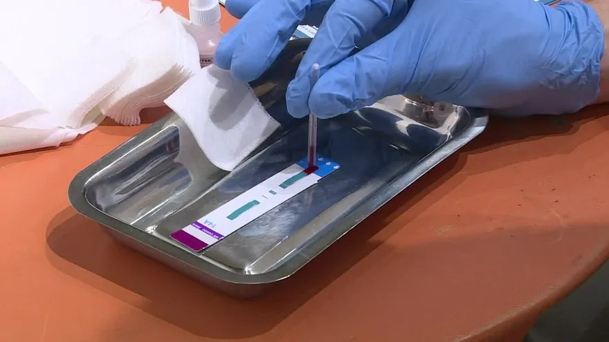 ONU “muy motivada” por segundo caso de remisión de VIH