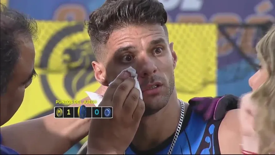 ¡El circuito de barriles dejó a Pablo con una cicatriz en la cara por una cortada!