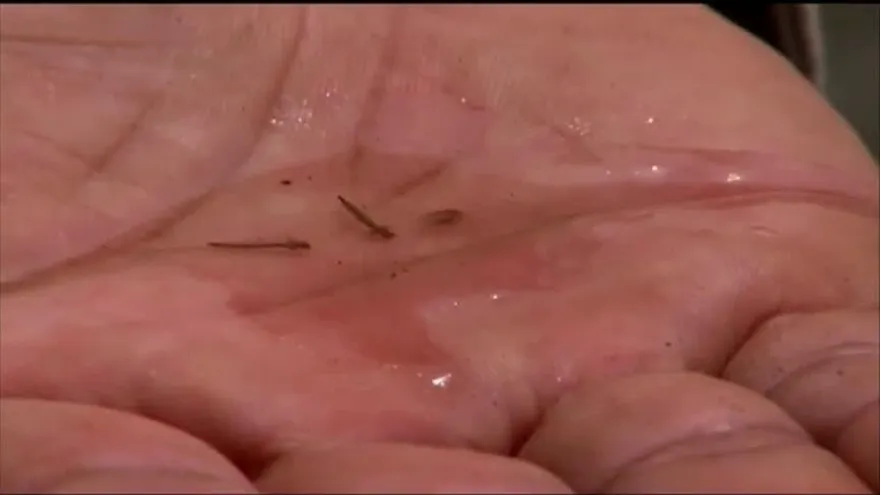 Reportan presencia de mosquito resistente a insecticidas