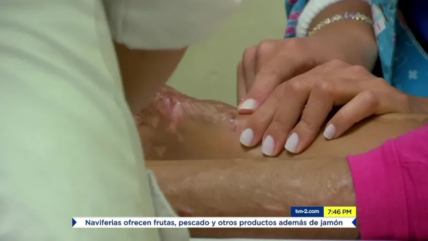 Conoce testimonios de las madres de niños quemados