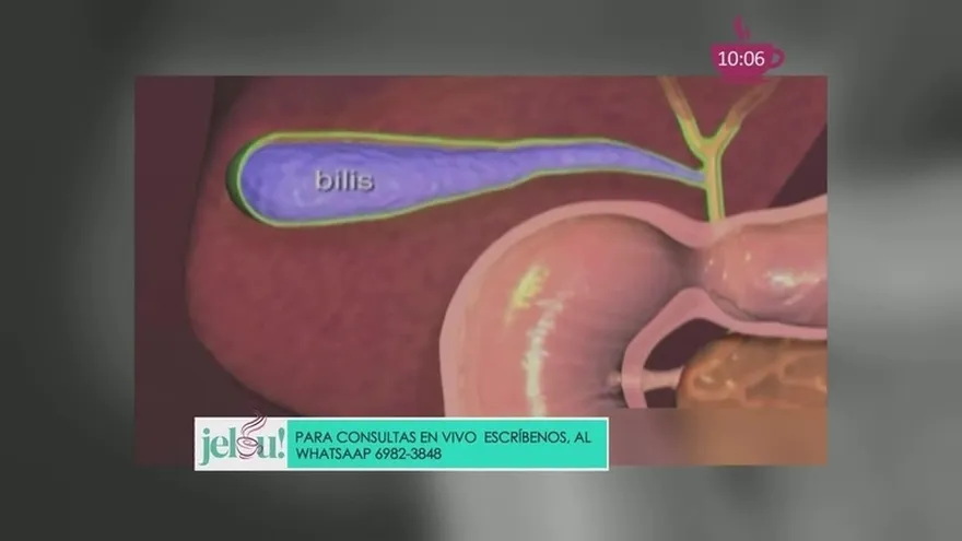 ¿Problemas con la vesícula? Preste atención si es su caso