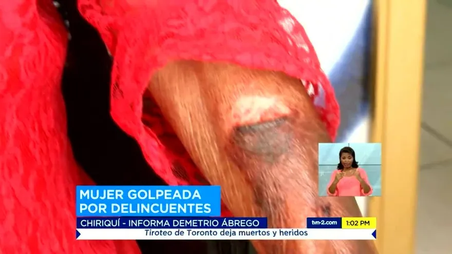 Adulta mayor es agredida por delincuentes en Chiriquí