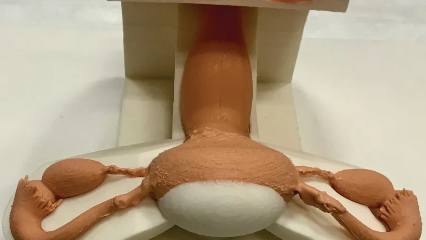 Fotografía cedida por la empresa Lazarus 3D donde se aprecia una réplica impresa en tres dimensiones (3D) del sistema reproductor femenino