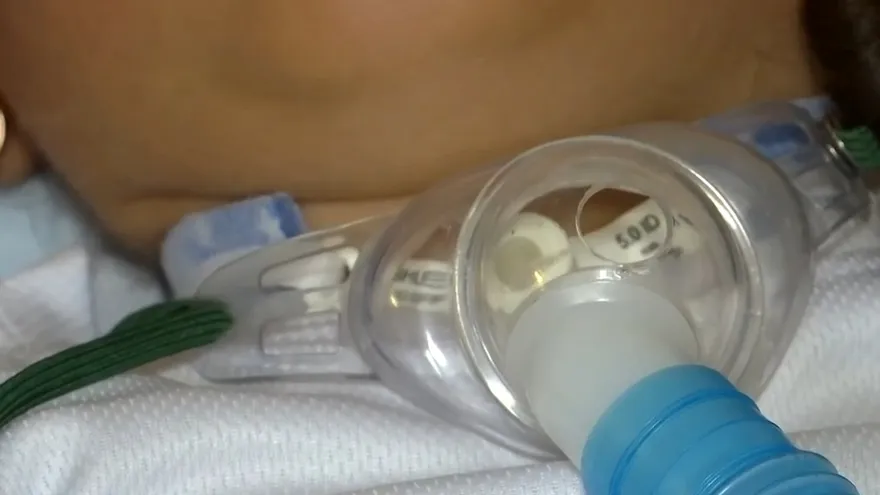 Niña en Pacora que sufre una rara enfermedad necesita tu ayuda