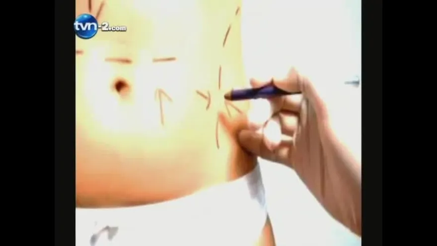 "Riesgos Por Vanidad"