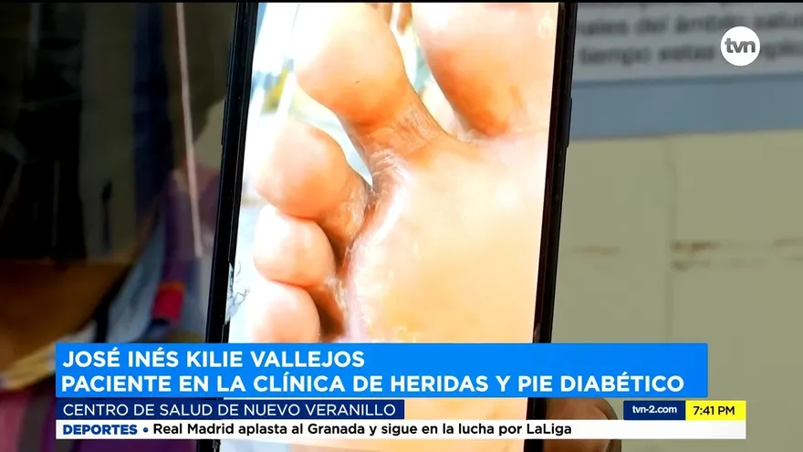 Historias de diabéticos que casi pierden su pierna en medio de la pandemia