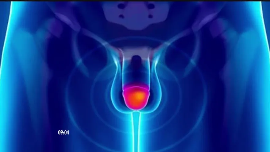 ¿Qué cuidados debes tener para evitar la irritación de tus genitales?