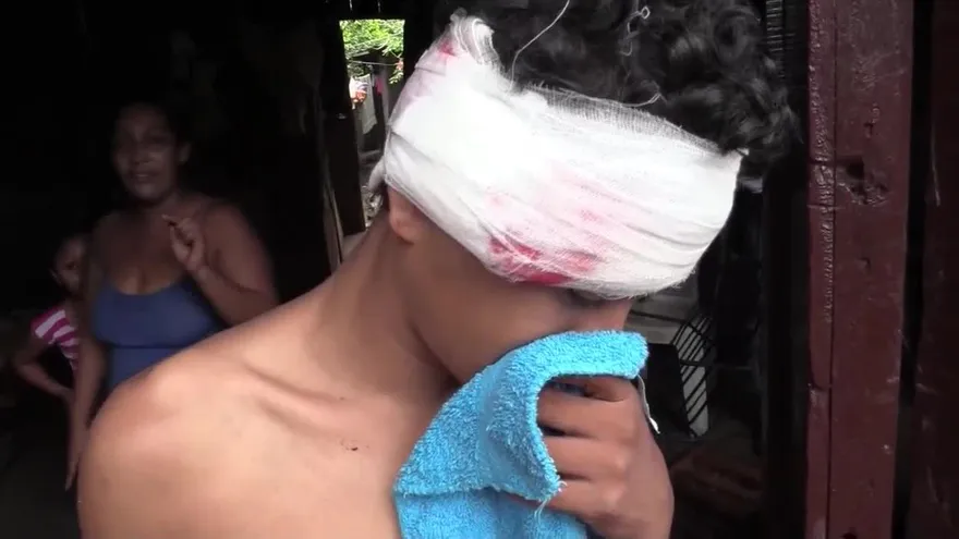 Se recrudece la violencia en Nicaragua y aumenta a 146 el número de muertos